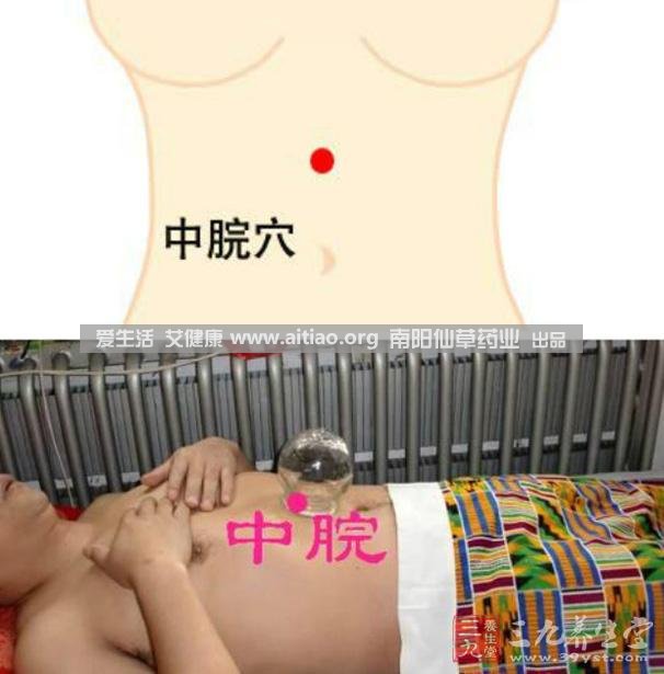 中脘穴位于腹部正中線，臍上4寸的位置上。每天艾灸10-15分鐘，能有效緩解胃部不適的癥狀，同時有助于祛濕。